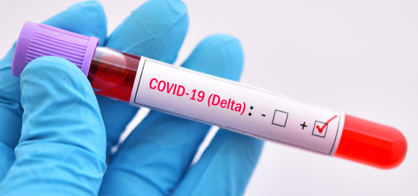 V Česku se již delta mutace koronaviru šíří komunitně, uvádí Státní zdravotní ústav