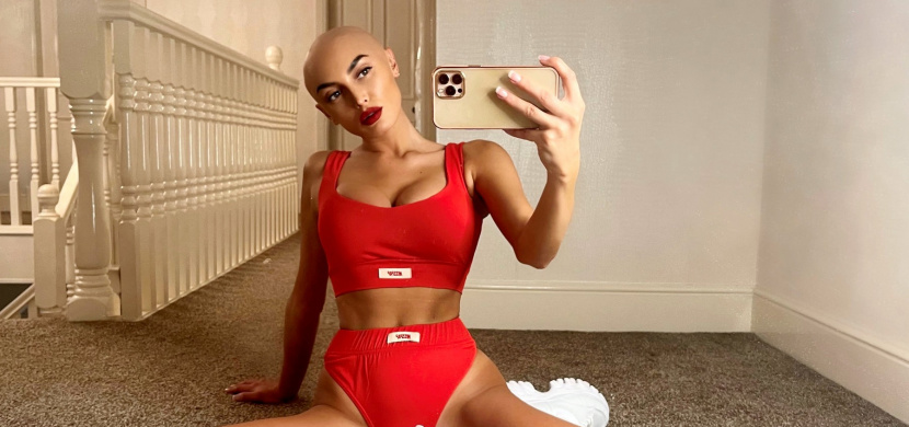 Modelka s alopecií ZaraLena Jackson svůj příběh sdílí na Instagramu. Vyjádřila se i ke kauze na předávání Oscarů 2022